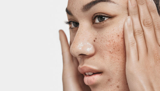 Stress And Skin - How Does Stress Impact Skin Health?